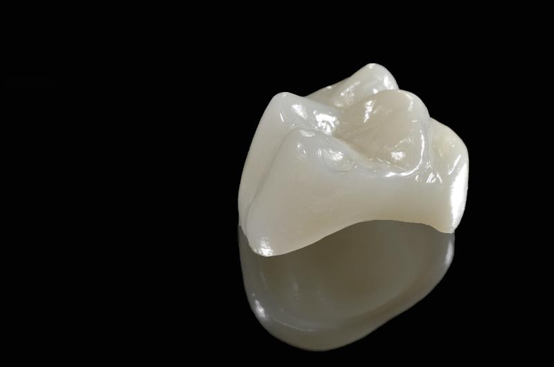 Porcelain Crowns Surrey, BC VR Z